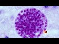 Africa 54 Health: Dangers of the Flu