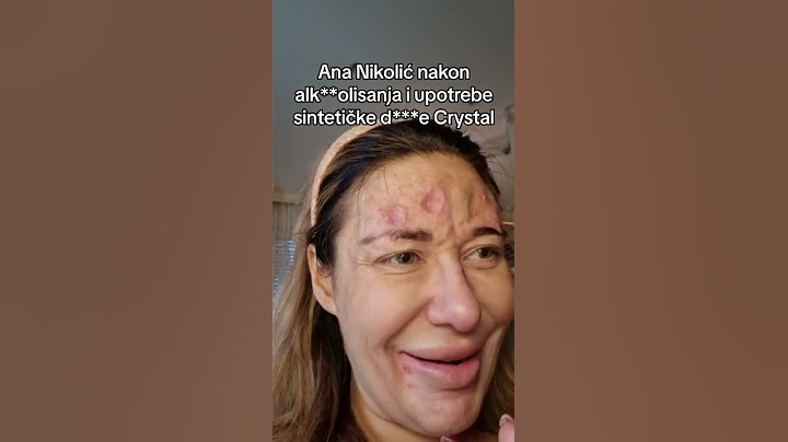 Procurio Strašan Video Ane Nikolić, Moli za Pomoć