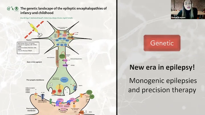 Dragoumi Popi, MD. Pediatric epilepsy.