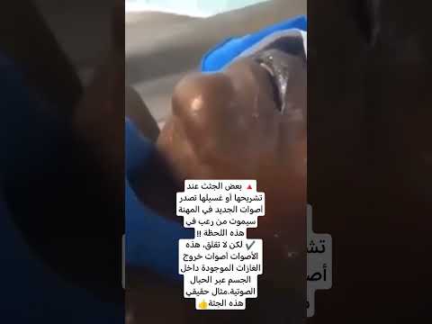 جثه تصدر صوت اثناء التشريح