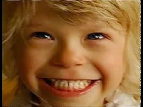 Основные симптомы синдрома вильямса. Дети эльфы синдром вильямса. Синдром вильямса лицо эльфа. Аутизм инфографика. Дети с лицом эльфа синдром вильямса.