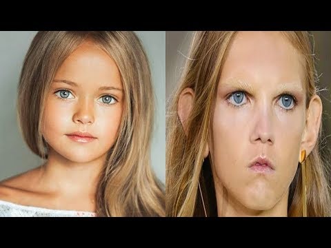 Video: Geçmişteki Güzellik: Plastikle Görünüşünü Bozan Modeller