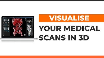 3Dicom for Patient Education - 3D Medical Image Viewer