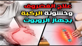 علاج الغضروف وخشونة الركبة بجهاز الروبوت  «أنا والدكتور» الدكتور وليد عمار