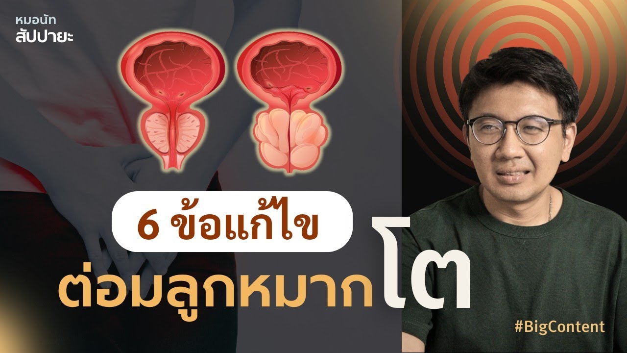 6 สาเหตุและการแก้ไข ต่อมลูกหมากโต - สัปปายะ Big Content