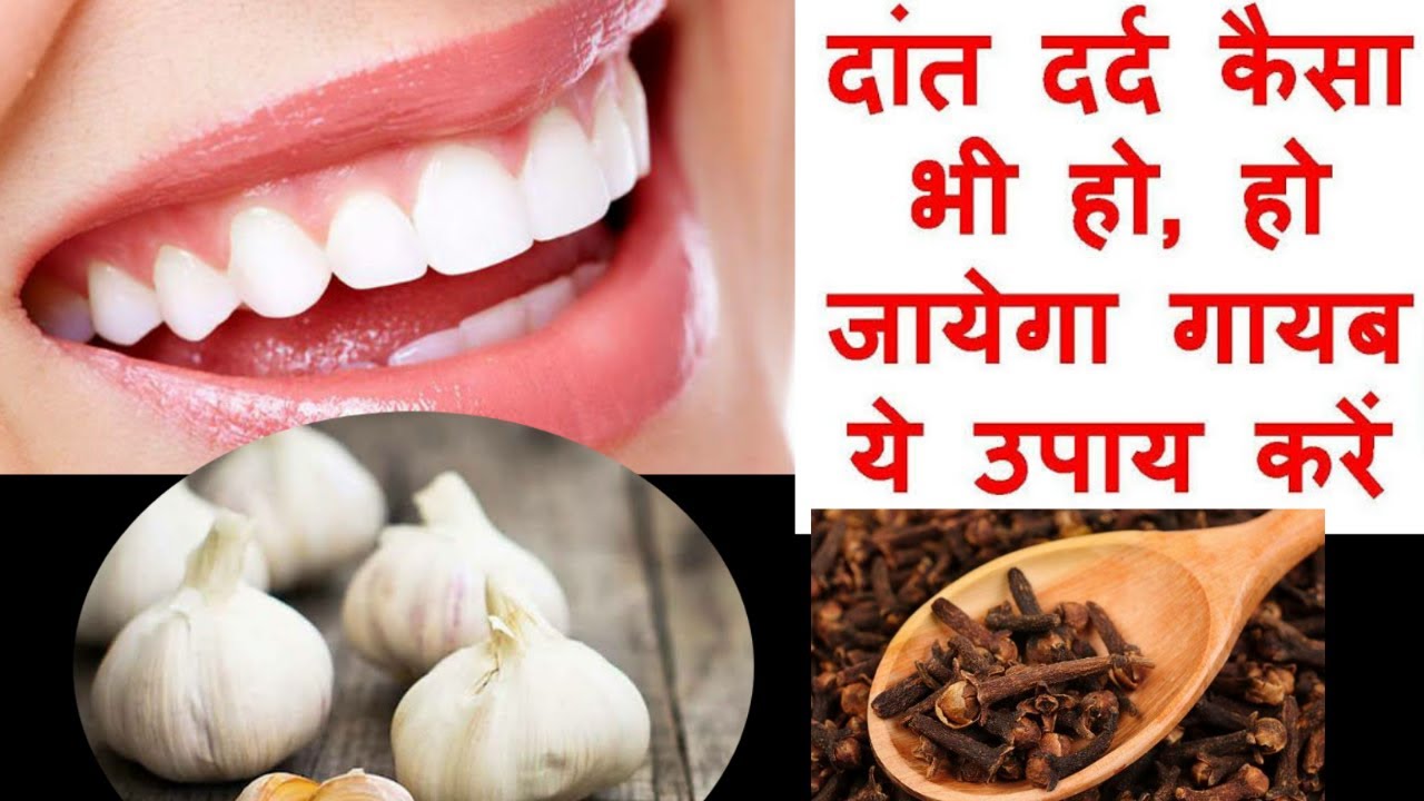 2 मिनट में दांत दर्द ख़त्म घरेलू इलाज/Home Remedy for Toothache/ Dant
