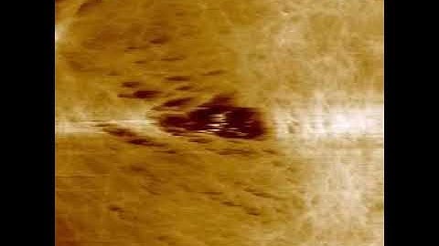 Actin Cortex Dynamics