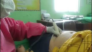 ❤beautiful pregnant❤