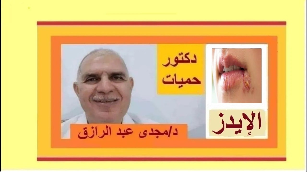 الإيدز وأسباب القرح الجلدية