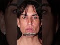 Face  lift plus jeuneet belle expression chirurgie du visage dr nabil fanous montreal