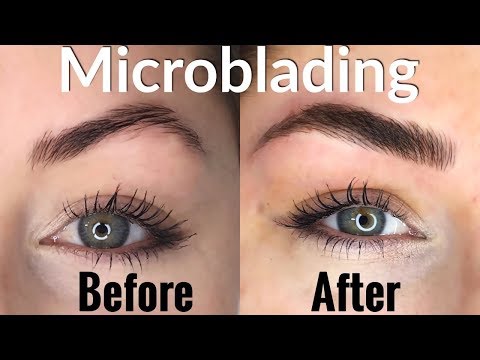 Where to get quality and cheap eye lid and Fibroblast in London ?
