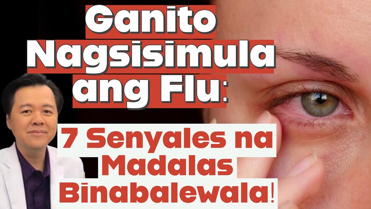 Ganito Nagsisimula ang Flu o Trangkaso: 7 Senyales na Madalas Balewalain! By Doc Willie Ong