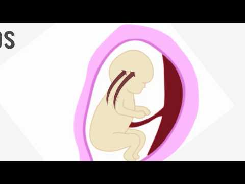 Video: Postterm Graviditet