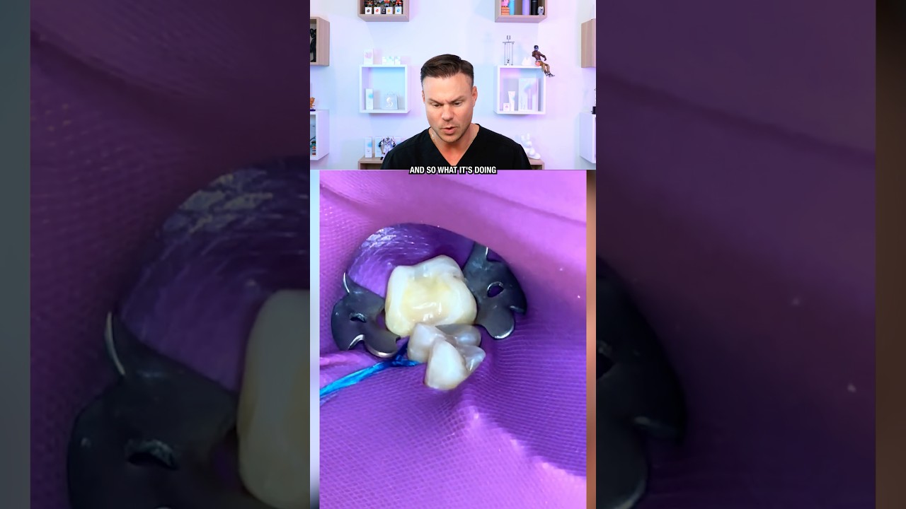 One Of Dentistry’s Most UNDERRATED Tools! 😮🦷