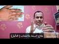 علاج السنط ( الثأليل ) بالاعشاب والأدوية وصفة مجربة وقوية