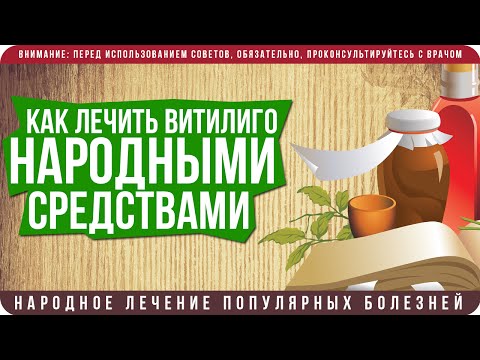 Как лечить витилиго народными средствами в домашних условиях