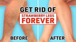 Bumpy Skin And Strawberry Legs? Transform It To The Smoothest Skin Every