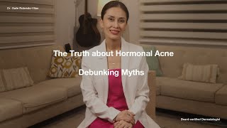 The TRUTH About HORMONAL ACNE: Debunking Myths | Dr Gaile Robredo-Vitas