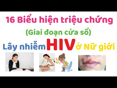16 biểu hiện triệu chứng HIV ở Nữ giới - YouTube