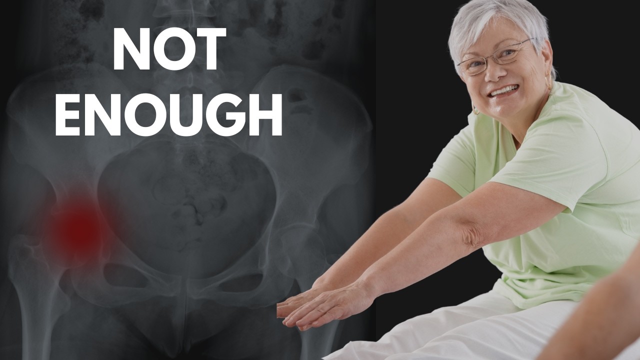 NHS GP: Why safe advice is failing your bones