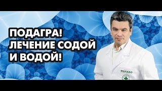 видео Как вылечить подагру в домашних условиях