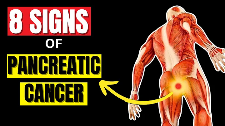 8 Symptoms of PANCREATIC CANCER That Will SHOCK YOU | Critical Warning Signs
