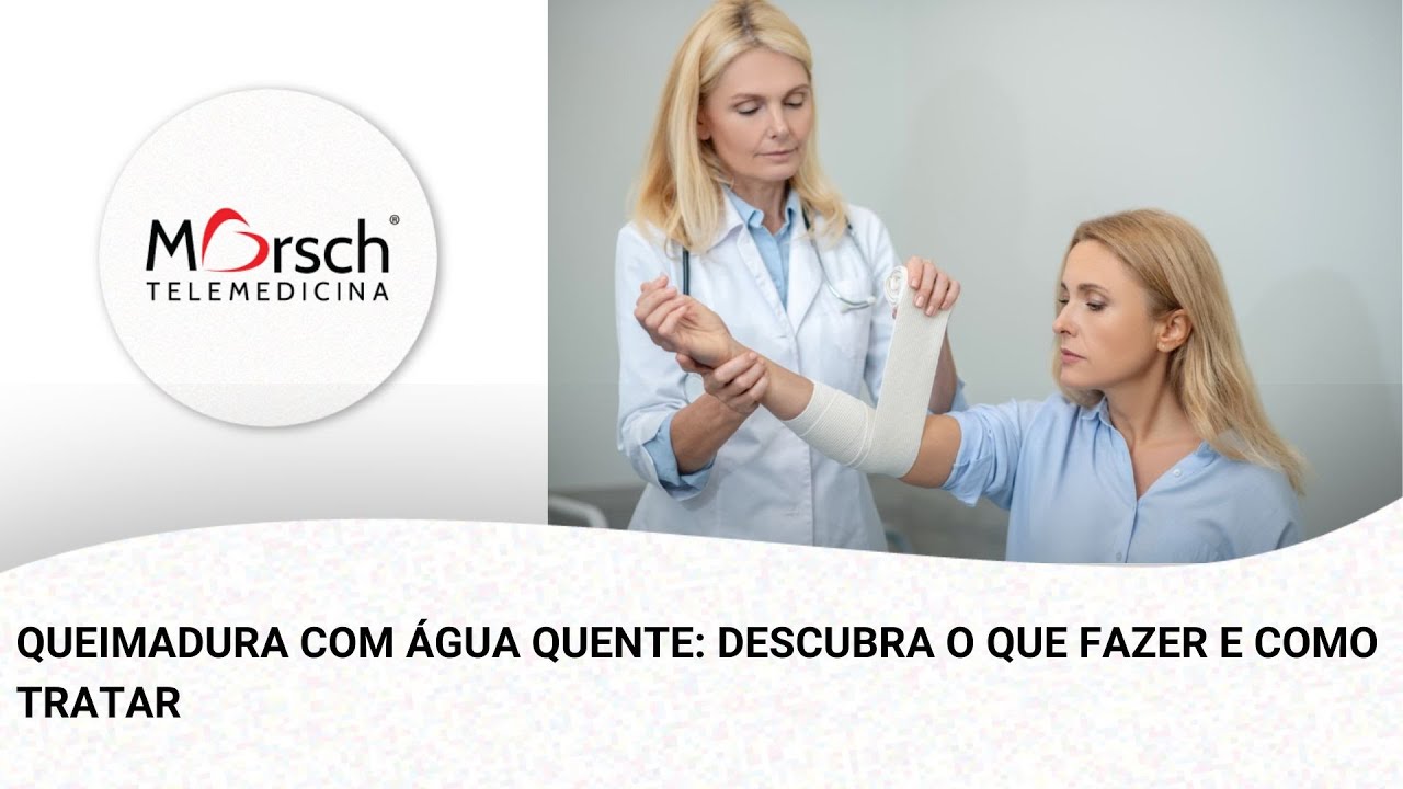 QUEIMADURA COM ÁGUA QUENTE: DESCUBRA O QUE FAZER E COMO TRATAR - YouTube