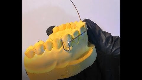 How to fabricate labial bow step by step