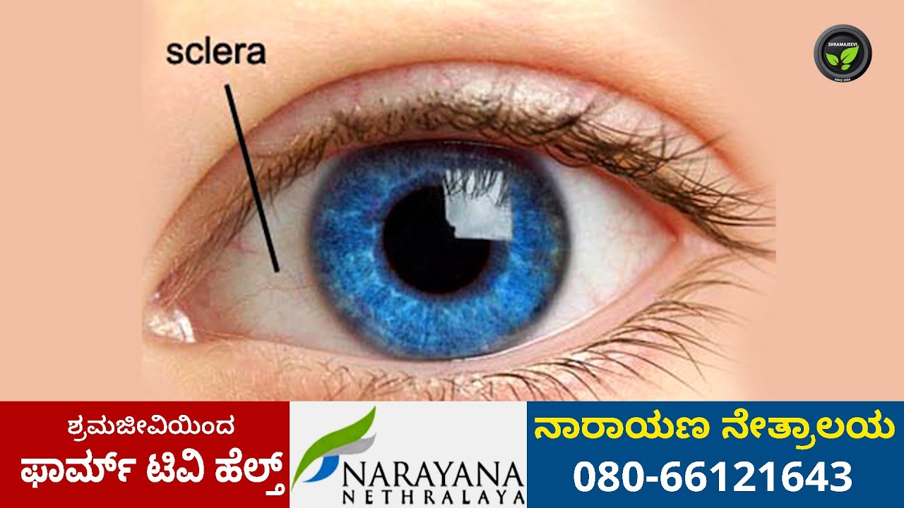 Eye is a wonderful organ eye parts   Dr G K Venkatesh  Most important organ Eye and its parts