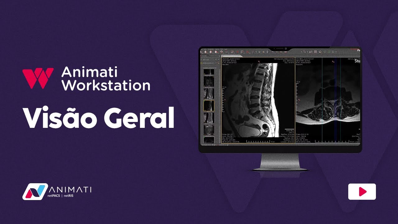 Animati Workstation - Visão Geral