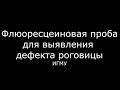 Флюоресцеиновая проба для выявления дефекта роговицы - meduniver.com