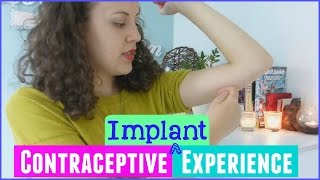 Contraceptive Implant experience(Hey everyone!! :) I've had my Implant in for nearly 5 years, I've now decided it's time to get it removed and to move to a natural method. Watch as I talk about the ..., 2015-07-27T18:03:56.000Z)