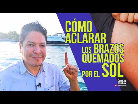 Video: 3 formas de aclarar la piel oscura del cuello