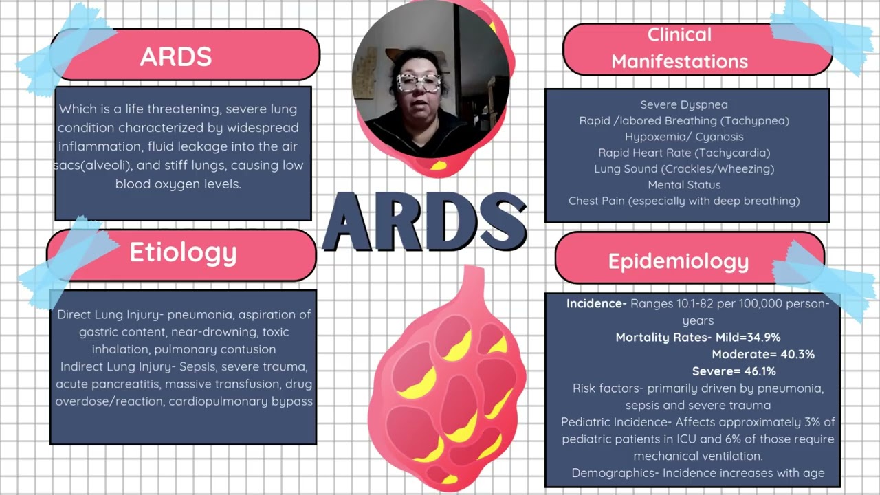 Prone Positioning/ARDS video 3