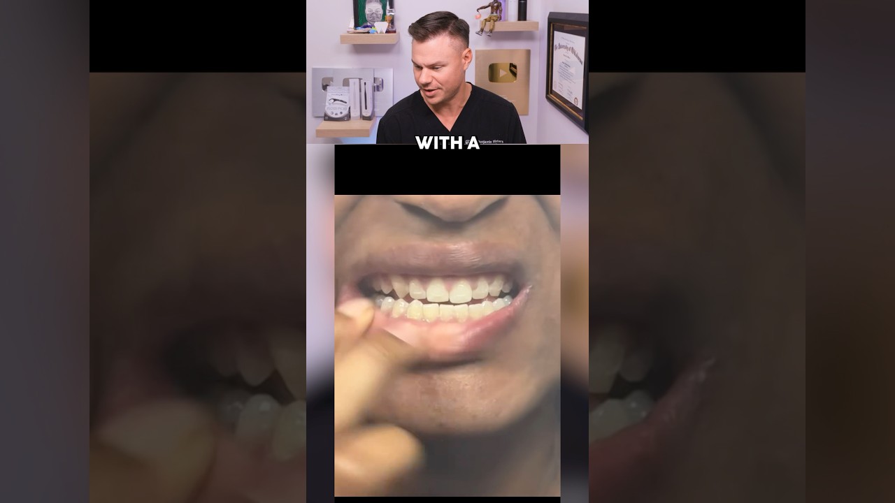 You Won’t Believe How She REMOVED Her Braces! 😮🦷