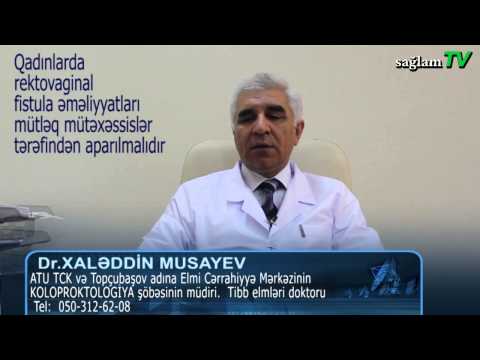 Rektovaginal fistuala. Dr. Xaleddin Musayev. REKTO-VAGINAL FISTULA