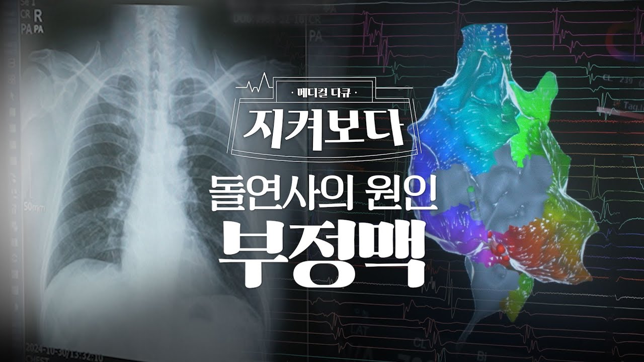 부정맥, 심장이 보내는 경고를 듣는 법(with 순환기내과 최의근 교수) | #지켜보다