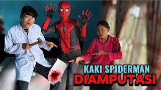 Viral Kaki Spiderman Diamputasi Kaki Spiderman Buntung