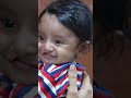 Baby Cleft Lip Surgery - 7 Days Results