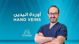 Hand Veins Treatment | Dr. Ali Haydar | علاج أوردة اليد