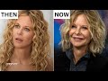 Meg Ryan's Mysterious Face Transformation