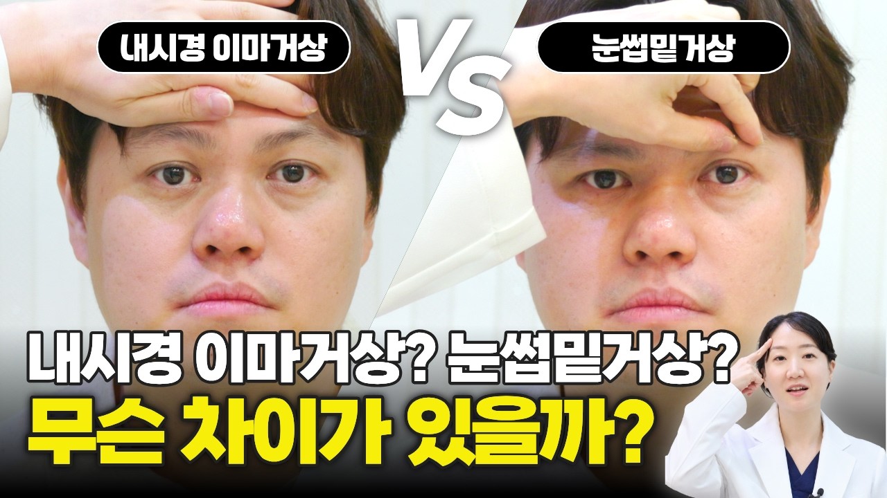 #눈수술 #눈성형 #눈처짐 #처진눈 #내시경이마거상 #눈썹밑거상 #눈꺼풀처짐 #눈썹처짐 #강형주 #제이준성형외과피부과 #남자성형 #남자눈성형 #남자코성형 #유명성형외과 #남자수술 #이마거상 #이마거상눈썹밑거상차이 #눈꼬리처짐 #이마주름 #중년눈성형 #이마거상회복기간 #눈썹밑거상회복기간 #강형주원장 #제이준성형외과