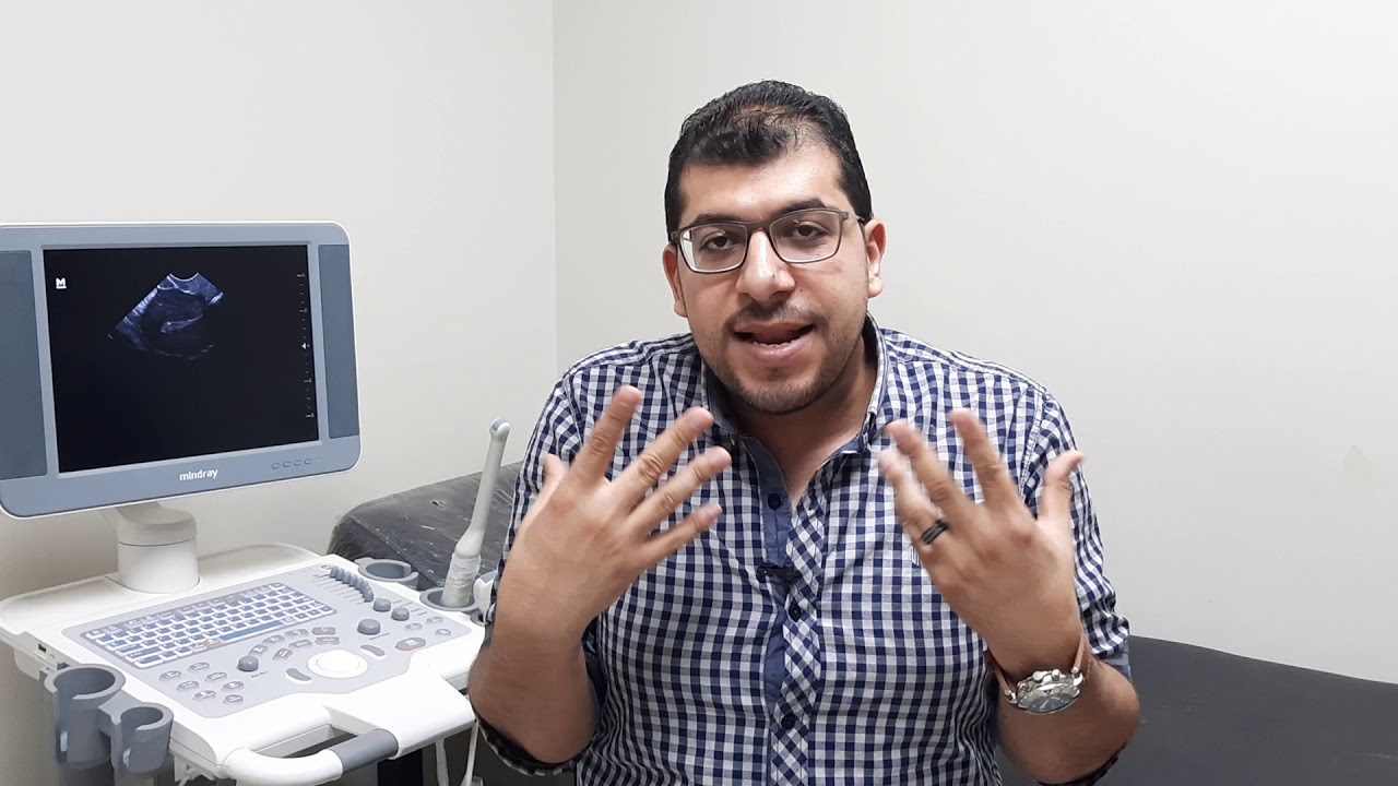 تجميد الحيوانات المنوية