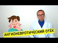 Ангионевротический ОТЁК. Что делать при отёке Квинке и как не допустить такой реакции