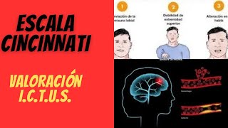 Escala de Cincinnati salva vidas, ¿Qué es y cómo funciona