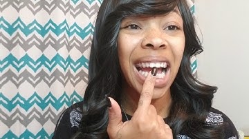 😁My byte journey (Therealmssmooth) Week 11 aligners😁