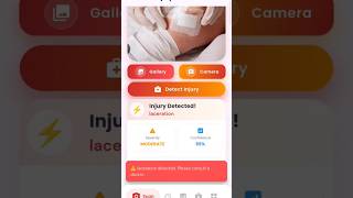 AI Injury Scanner Flutter Mobile App #flutter #mobileapps #injuryprevention #injuryrecovery #ai