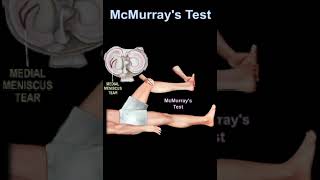 McMurray&#39;s Test #shorts