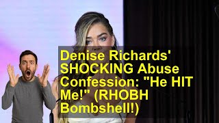 Denise Richards' SHOCKING Abuse Confession: "He HIT Me!" (RHOBH Bombshell!)