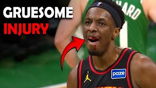 Onyeka Okongwu Injury: Shocking Blow From Jaylen Brown Leaves Hawks Star Hurt